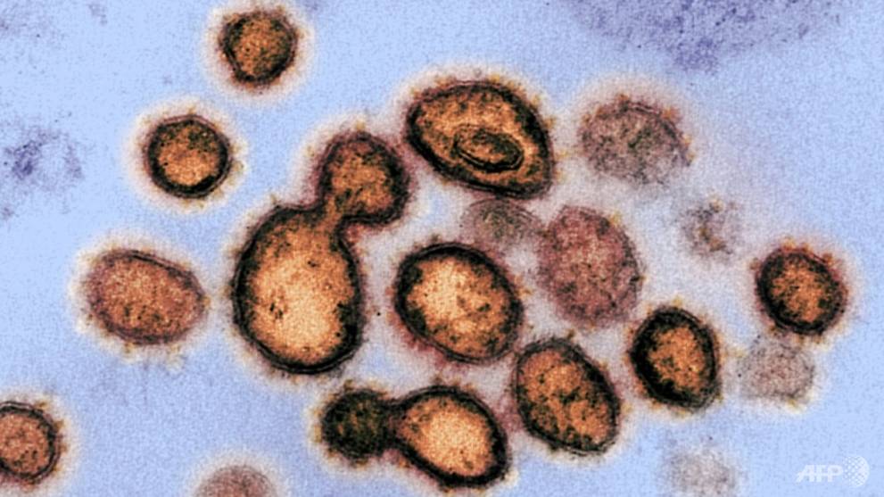 an-image-of-the-sars-cov-2-the-virus-that-causes-covid-19-1583353341230-4.jpg
