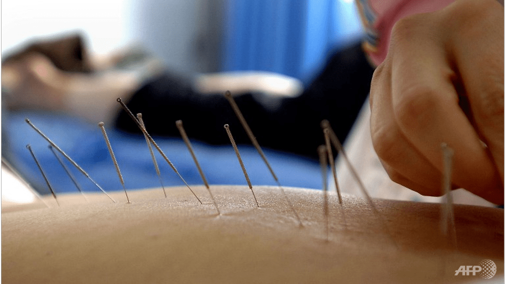 acupuncture---2171936.png